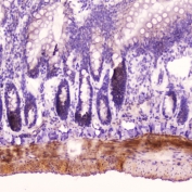 IHC testing of FFPE rat small intestine tissue with ANP antibody at 2ug/ml. HIER: boil tissue sections in pH6, 10mM citrate buffer, for 10-20 min followed by cooling at RT for 20 min.