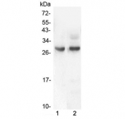 Western blot testing of 1) rat intestinal smooth muscle and 2) mouse intestinal smooth muscle lysate with PDCD10 antibody at 0.5ug/ml. Predicted molecular weight ~25 kDa.