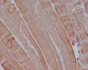 IHC testing of FFPE mouse muscle with Alpha Actin antibody at 2ug/ml. HIER: boil tissue sections in pH6, 10mM citrate buffer, for 10-20 min followed by cooling at RT for 20 min.
