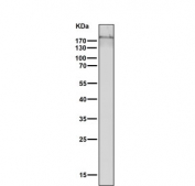 Western blot testing of human PC-3 cell lysate with Collagen XVII antibody. Expected molecular weight ~120 kDa and ~180 kDa.