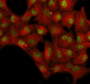 Immunofluorescent staining of FFPE human A549 cells with SP antibody (green) and Beta Tubulin mAb (red). HIER: steam section in pH6 citrate buffer for 20 min.