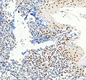 IHC staining of FFPE human tonsillitis tissue with SP1 antibody. HIER: boil tissue sections in pH8 EDTA for 20 min and allow to cool before testing.