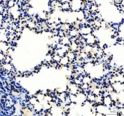 IHC staining of FFPE mouse lung tissue with SP1 antibody. HIER: boil tissue sections in pH8 EDTA for 20 min and allow to cool before testing.