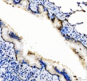 IHC staining of FFPE rat lung tissue with SP1 antibody. HIER: boil tissue sections in pH8 EDTA for 20 min and allow to cool before testing.