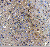 IHC staining of FFPE mouse brain tissue with Amphiregulin antibody. HIER: boil tissue sections in pH8 EDTA for 20 min and allow to cool before testing.