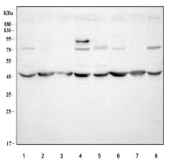 Western blot testing of 1) rat brain, 2) rat thymus, 3) rat spleen, 4) rat PC-12, 5) mouse brain, 6) mouse thymus, 7) mouse spleen and 8) mouse RAW264.7 cell lysate with Amphiregulin antibody at 0.5ug/ml.  Molecular weight: 28 kDa (non-glycosylated), ~50 kDa (glycosylated pro form), ~43 kDa (predominant glycosylated soluble form) as well as other, smaller, soluble and membrane bound forms.