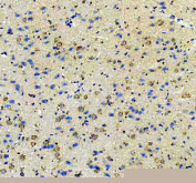 IHC staining of FFPE rat brain tissue with Amphiregulin antibody. HIER: boil tissue sections in pH8 EDTA for 20 min and allow to cool before testing.