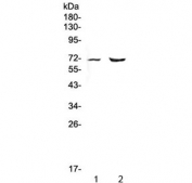 Western blot testing of 1) rat heart and 2) mouse heart lysate with PMEL17 antibody at 0.5ug/ml. Predicted molecular weight: ~70 kDa (unmodified), ~100 kDa (glycosylated).
