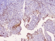IHC staining of FFPE human tonsil tissue with CD1b antibody at 1ug/ml. HIER: boil tissue sections in pH6, 10mM citrate buffer, for 10-20 min followed by cooling at RT for 20 min.