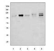 Western blot testing of 1) rat kidney and 2) mouse kidney lysate with DDR2 antibody at 0.5ug/ml. Predicted molecular weight ~97 kDa but may be observed at higher molecular weights due to glycosylation.