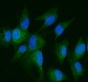 Immunofluorescent staining of FFPE human U-87 MG cells with DDR2 antibody (green) and DAPI nuclear stain (blue). HIER: steam section in pH6 citrate buffer for 20 min.