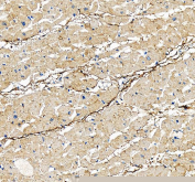 IHC staining of FFPE human heart tissue with DDR2 antibody, HRP-secondary and DAB substrate. HIER: boil tissue sections in pH8 EDTA for 20 min and allow to cool before testing.