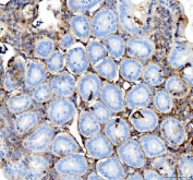 IHC staining of FFPE mouse colon tissue with IFNG antibody. HIER: boil tissue sections in pH8 EDTA for 20 min and allow to cool before testing.