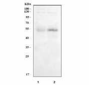 Western blot testing of human 1) HeLa and 2) A549 cell lysate with TNF Receptor antibody. Predicted molecular weight ~51 kDa.