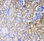 IHC staining of FFPE mouse kidney tissue with TNF Receptor antibody. HIER: boil tissue sections in pH8 EDTA for 20 min and allow to cool before testing.