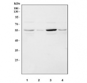 Western blot testing of 1) rat brain, 2) rat lung, 3) mouse brain and 4) mouse lung tissue lysate with TNF Receptor antibody. Predicted molecular weight ~51 kDa.