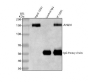 Immunoprecipitation of Anillin protein from 500ug of human U-251 whole cell lysate with 2ug of Anillin antibody.