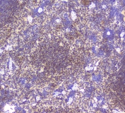 IHC staining of FFPE mouse spleen tissue with Bcl6 antibody at 1ug/ml. HIER: boil tissue sections in pH6, 10mM citrate buffer, for 10-20 min followed by cooling at RT for 20 min.