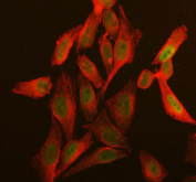 Immunofluorescent staining of FFPE human HeLa cells with DIS3 antibody (green) and Beta Tubulin mAb (red). HIER: steam section in pH6 citrate buffer for 20 min.
