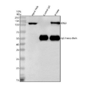 Immunoprecipitation of DIS3 protein from 500ug of human HeLa whole cell lysate with 2ug of DIS3 antibody.
