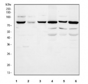 Western blot testing of 1) human K562, 2) human HEL, 3) human Jurkat, 4) rat brain, 5) rat PC-12 and 6) mouse brain tissue lysate with PKC beta antibody. Predicted molecular weight ~76 kDa.