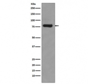 Western blot testing of human 22RV1 lysate with AR-V7 antibody. Predicted molecular weight ~68 kDa but routinely observed at ~80 kDa.