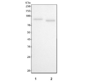 Western blot testing of human 1) A431 and 2) HaCaT cell lysate with ADAM10 antibody. Predicted molecular weight: ~84 kDa (full length), ~60 kDa (active form), ~80 kDa (glycosylated active form), ~110 kDa (glycosylated full length).