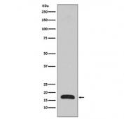 Western blot testing of human fetal brain lysate with p16 ARC antibody. Predicted molecular weight ~16 kDa.