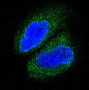 IF/ICC staining of human A431 cells with TAK1 antibody (green) and DAPI nuclear stain (blue).