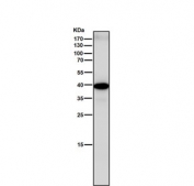 Western blot testing of rat heart tissue lysate with Sprouty 2 antibody. Expected molecular weight: 35-39 kDa, may be observed as a doublet.