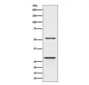 Western blot testing of human Jurkat cell lysate with PARK2 antibody. Expected molecular weight: 50-60 kDa with multiple smaller isoforms (possible ~30 kDa isoform visualized here).