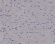 IHC staining of FFPE rat heart tissue with NBS1 antibody. HIER: boil tissue sections in pH6, 10mM citrate buffer, for 10-20 min and allow to cool before testing.