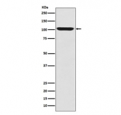 Western blot testing of human fetal skeletal muscle with GPR49 antibody. Predicted molecular weight ~100 kDa.