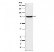 Western blot testing of human fetal brain lysate with NTN1 antibody. Expected molecular weight: 68-75 kDa depending on glycosylation level.