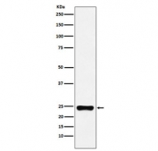 Western blot testing of human HeLa cell lysate with BAG2 antibody. Predicted molecular weight ~22 kDa.