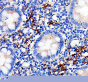 IHC staining of FFPE human appendix tissue with Factor XIIIa antibody, HRP-secondary and DAB substrate. HIER: boil tissue sections in pH8 EDTA for 20 min and allow to cool before testing.