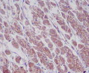 IHC staining of FFPE rat stomach tissue with Phospho-EGF Receptor antibody, HRP-secondary and DAB substrate. HIER: boil tissue sections in pH8 EDTA for 20 min and allow to cool before testing.
