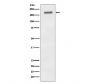 Western blot testing of lysate from human A431 cells treated with EGF with Phospho-EGFR antibody. Expected molecular weight: 134-170 kDa depending on glycosylation level.