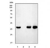 Western blot testing of 1) human HepG2, 2) human Caco-2, 3) rat liver and 4) mouse liver tissue lysate with AKR1D1 antibody at 0.5ug/ml. Predicted molecular weight ~37 kDa.