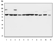 Western blot testing of 1) human HepG2, 2) human Jurkat, 3) human CCRF-CEM, 4) human K562, 5) human A549, 6) human Caco-2, 7) human HeLa, 8) rat brain, 9) rat C6, 10) mouse brain and 11) mouse Neuro-2a cell lysate with PTPN11 antibody. Predicted molecular weight ~68 kDa.