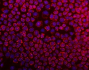 Immunofluorescent staining of FFPE human A431 cells with DARS2 antibody (red) at 2ug/ml and DAPI nuclear stain (blue). HIER: steam section in pH6 citrate buffer for 20 min.