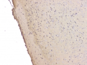 IHC staining of FFPE mouse brain with SRCIN1 antibody at 1ug/ml. HIER: boil tissue sections in pH6, 10mM citrate buffer, for 10-20 min and allow to cool before testing.