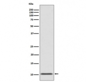 Western blot testing of human fetal pancreas with GLP-1 antibody. Predicted molecular weight ~3 kDa but can be observed at up to ~21 kDa depending on Proglucagon cleavage.