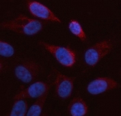 Immunofluorescent staining of FFPE human PC-3 cells with ARAF antibody (red) and DAPI nuclear stain (blue). HIER: steam section in pH6 citrate buffer for 20 min.
