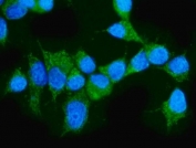 Immunofluorescent staining of FFPE human MCF7 cells with ARAF antibody (green) and DAPI nuclear stain (blue). HIER: steam section in pH6 citrate buffer for 20 min.