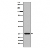 Western blot testing of human plasma lysate with Lambda light chain antibody. Predicted molecular weight: 22-25 kDa.