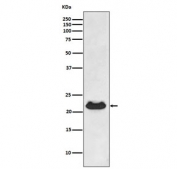 Western blot testing of human fetal heart lysate with Alpha B Crystallin antibody. Predicted molecular weight ~20 kDa.
