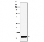 Western blot testing of human spleen lysate with PF4 antibody. Expected molecular weight: ~8/16/32 kDa (monomer/dimer/tetramer).