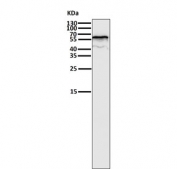 Western blot testing of human K562 cell lysate with ER alpha antibody. Predicted molecular weight ~66 kDa.