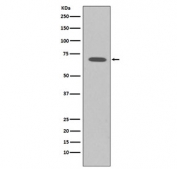 Western blot testing of human K562 cell lysate with Raf1 antibody. Predicted molecular weight ~73 kDa.
